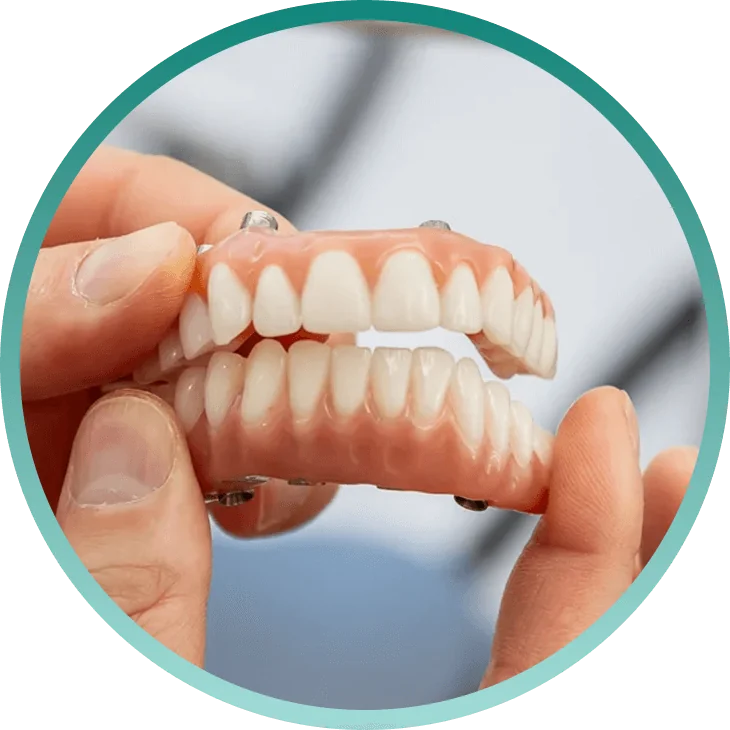 Implant-supported full-arch denture held by a dental professional