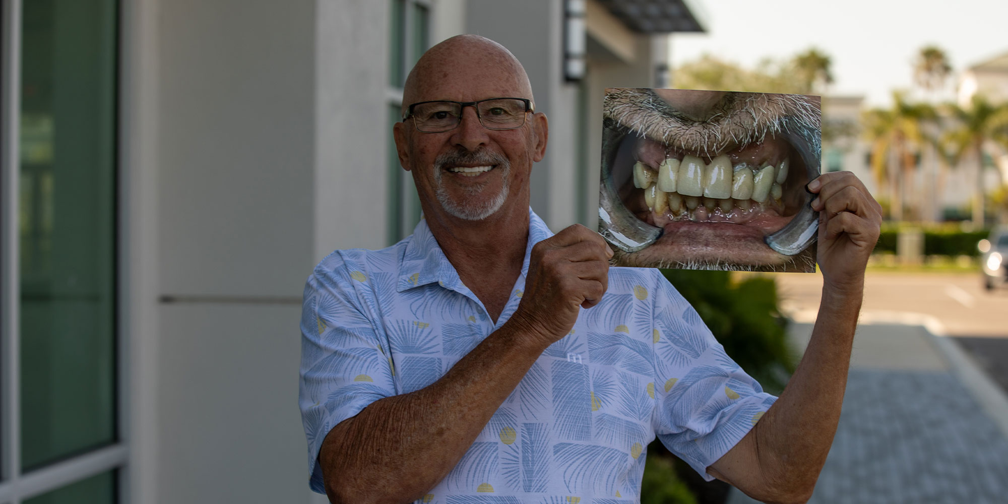 Patient holding up a before and after photo of their smile