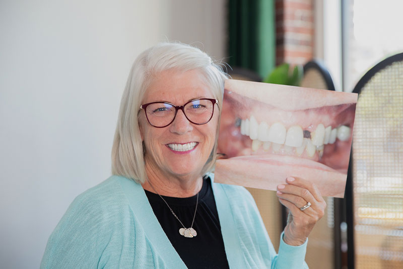 Kandi - Dental Implants